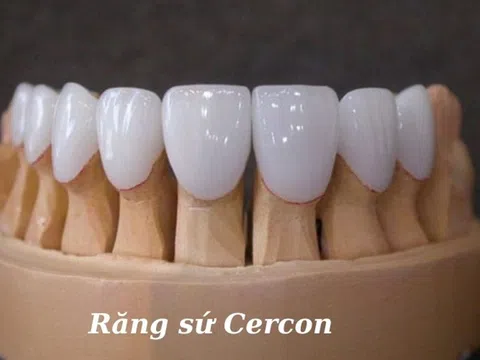 Nha khoa Quốc tế DAISY địa chỉ bọc răng sứ Cercon uy tín, chất lượng